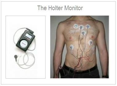Monitorizarea prin Holter